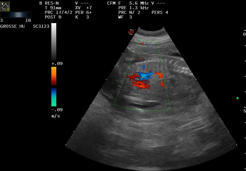 Ultraschall Bild
